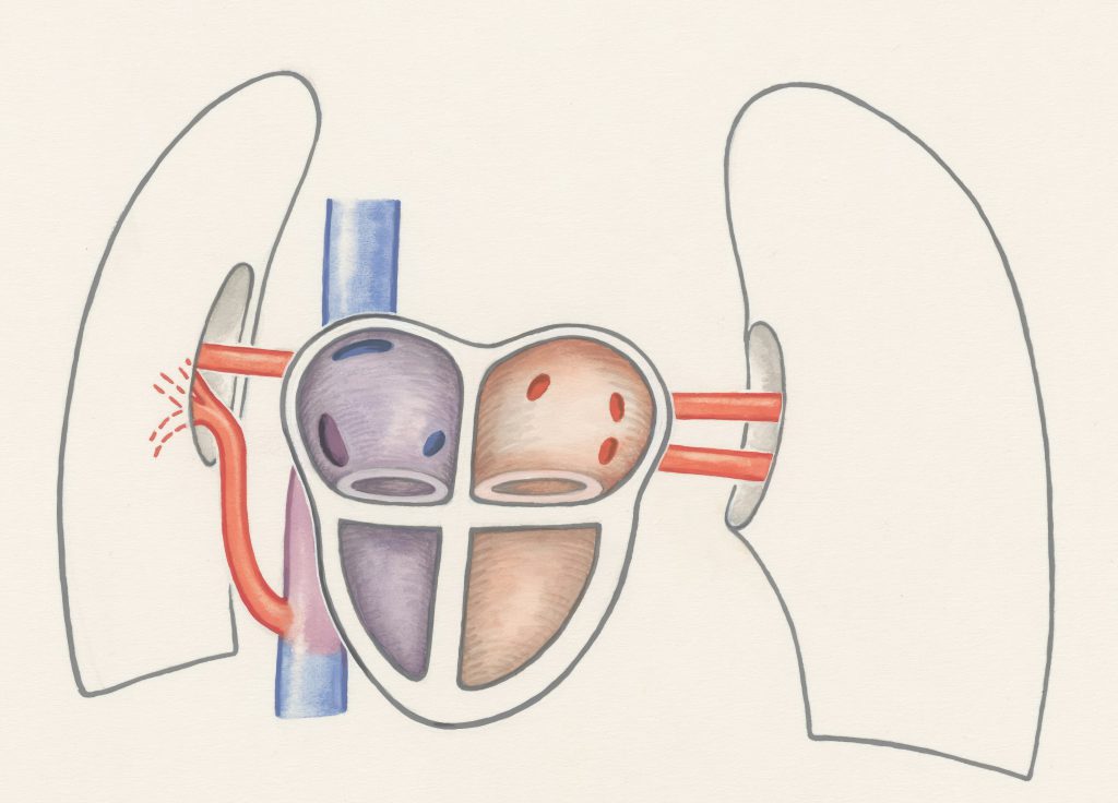 Schematische medizinische Zeichnung von Herz und Lungen mit Blutgefäßen auf hellem Hintergrund