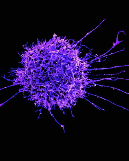 Mikroskopische Aufnahme einer violetten, verzweigten Zellstruktur vor schwarzem Hintergrund