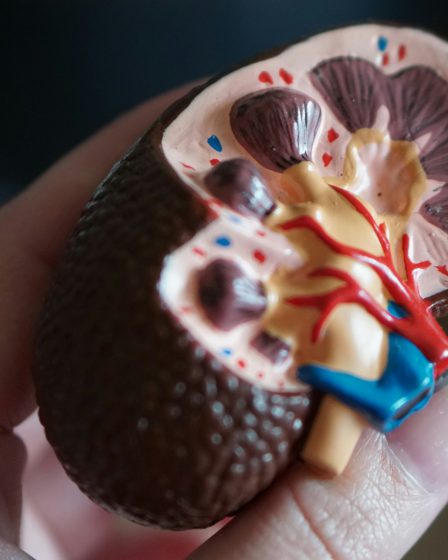 Nahaufnahme einer Hand, die ein anatomisches Modell einer aufgeschnittenen Niere mit sichtbaren Blutgefäßen und inneren Strukturen hält