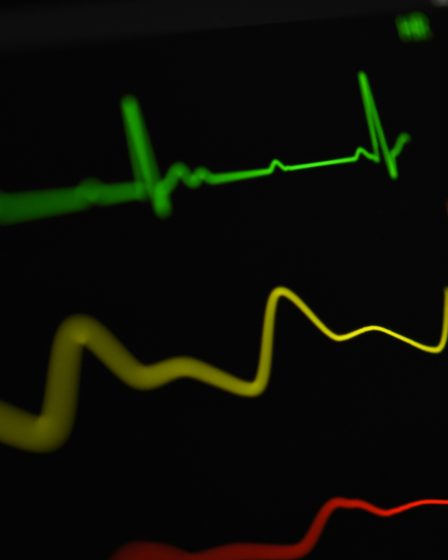 Ein dunkler Herzmonitor mit grüner EKG-Kurve und gelben Vitalwerten – Messung der Herzfrequenzvariabilität (HRV) im Sport.