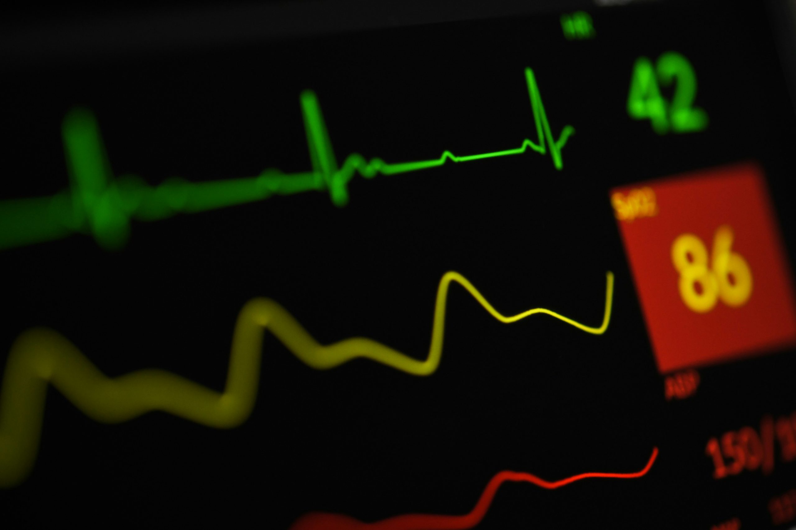 Ein dunkler Herzmonitor mit grüner EKG-Kurve und gelben Vitalwerten – Messung der Herzfrequenzvariabilität (HRV) im Sport.